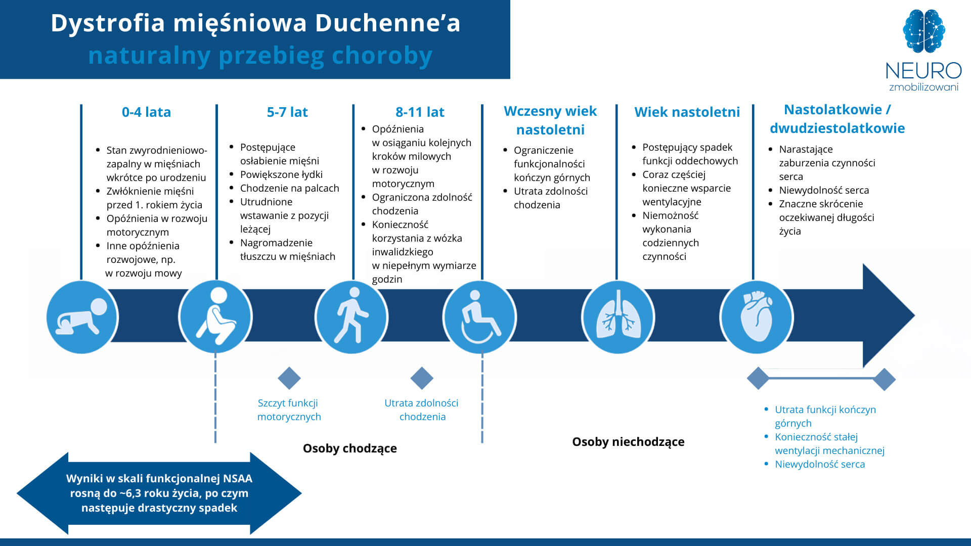 DMD - przebieg choroby